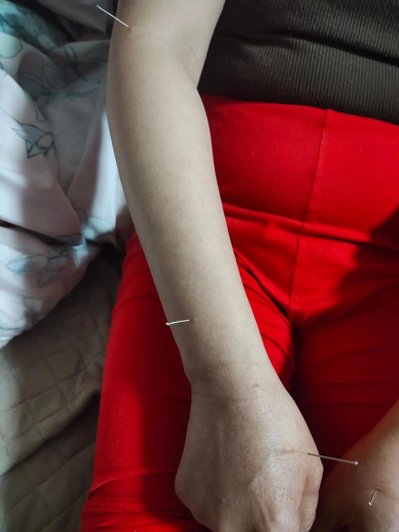 肝郁气滞针灸能治好吗