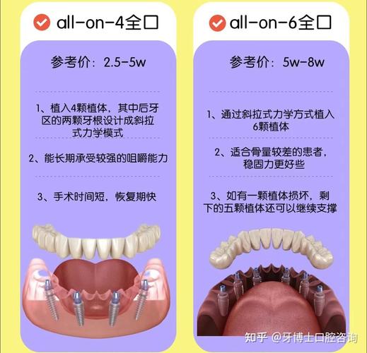 西安全口种植牙多少钱