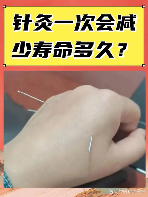 美容院针灸减肥靠谱吗