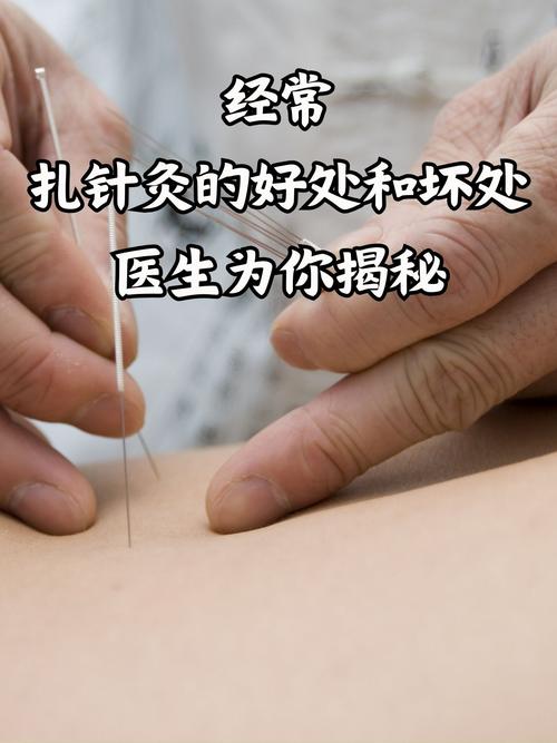 针灸扎到大动脉会死吗