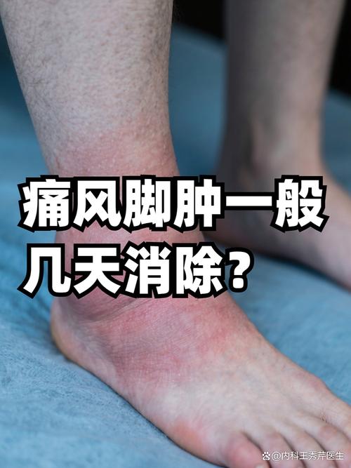 路走多了会引起痛风吗