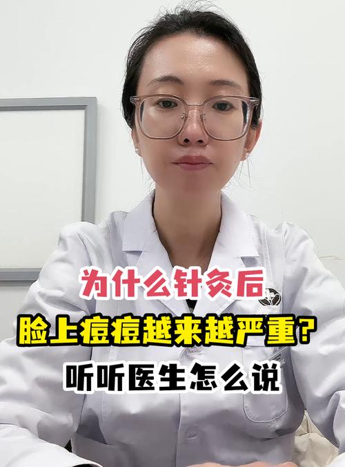 针灸后为什么脸上长痘
