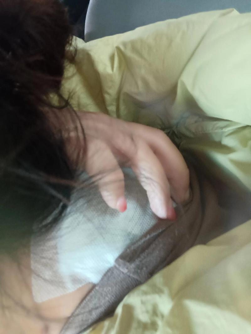 针灸后起包是怎么回事