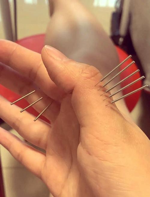 董氏针灸72绝针图片