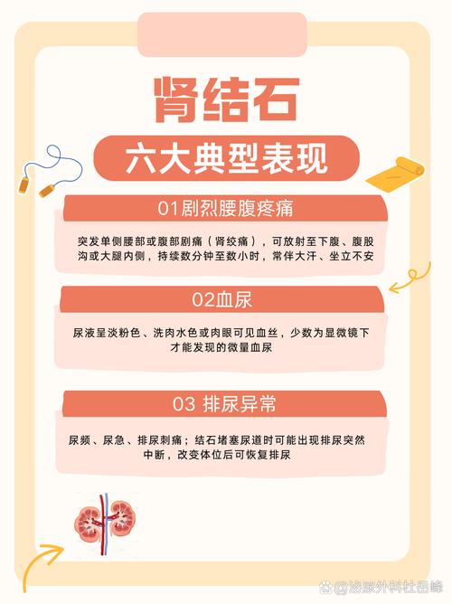 痛风和肾结石哪个更痛