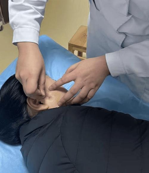 同仁医院针灸治疗鼻炎