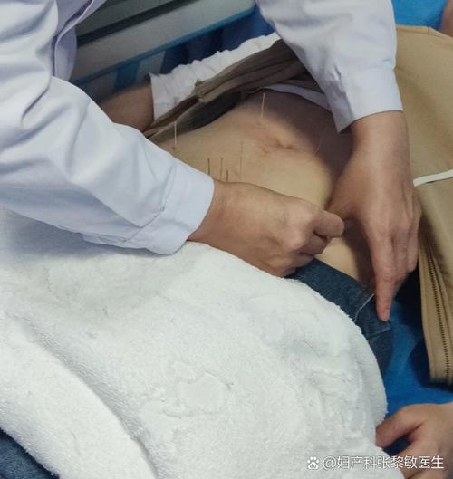 针灸能恢复卵巢功能吗