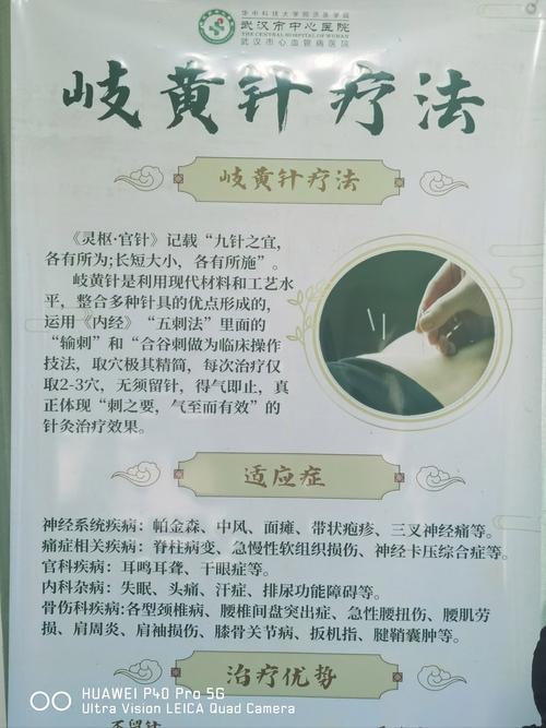 黄土根针灸哪里有坐诊