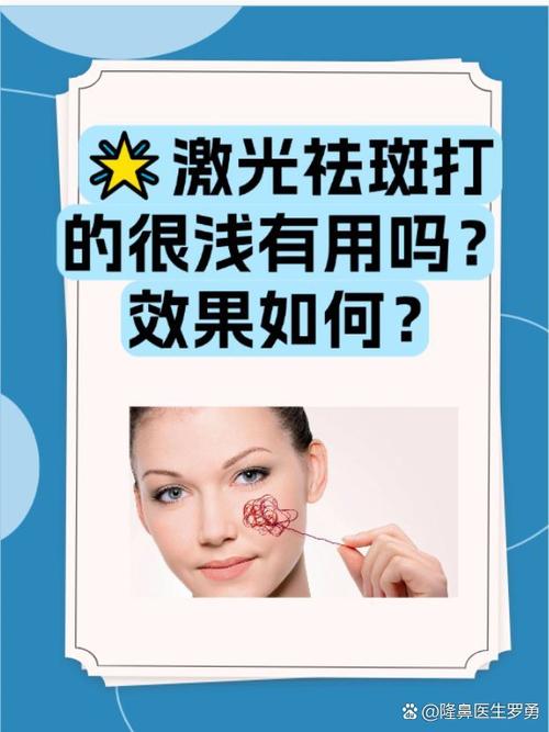 脸部做激光祛斑安全吗