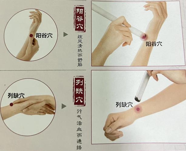 腕关节腱鞘炎怎么针灸