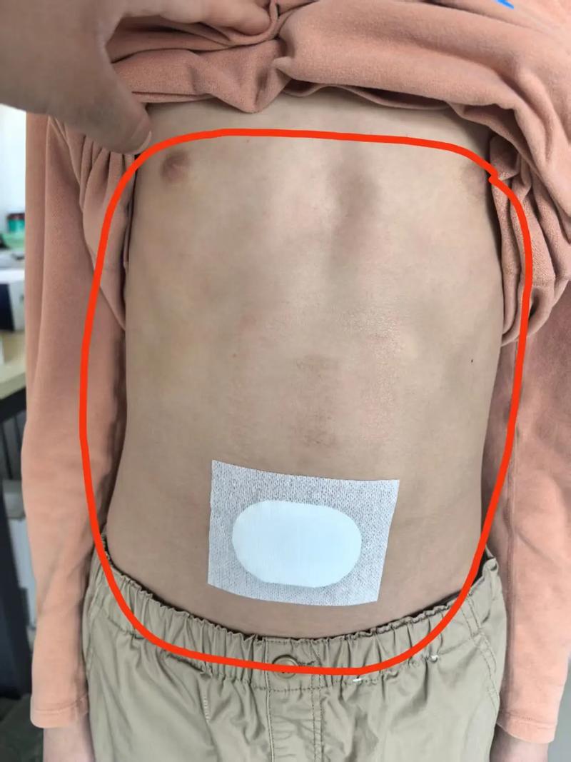 中科贴针灸效果怎么样