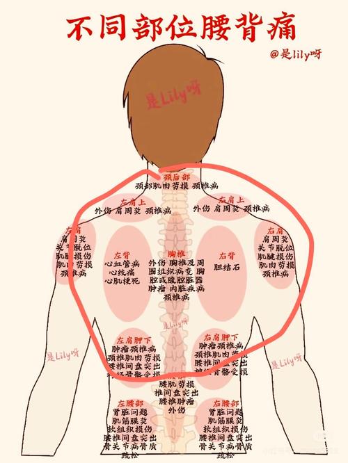 背痛针灸扎那几个学位