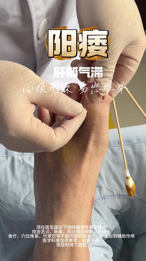 针灸治疗阳萎一个疗程