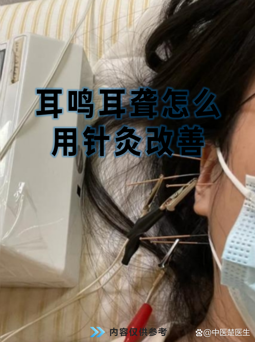 耳鸣针灸后严重怎么办