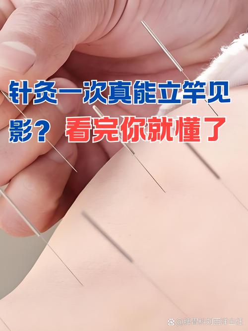 无针针灸真的有效果吗