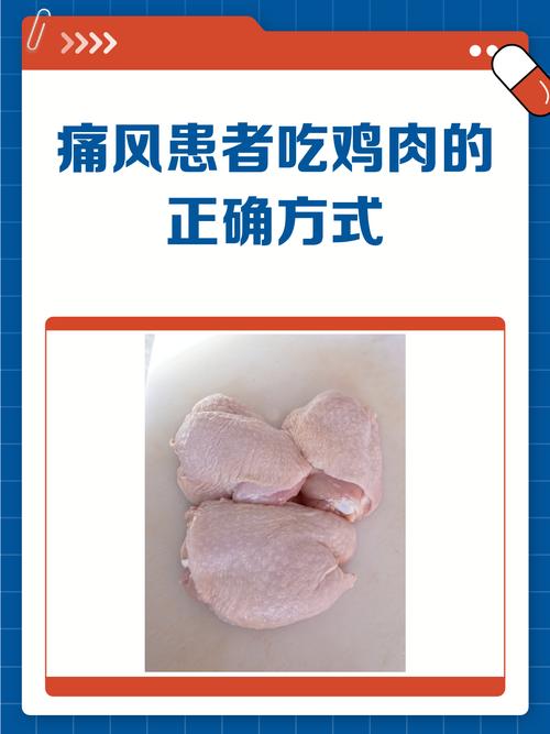 痛风可以吃咖喱鸡肉吗