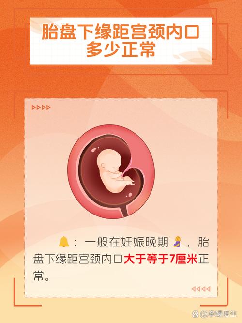 胎盘距宫颈口多少安全