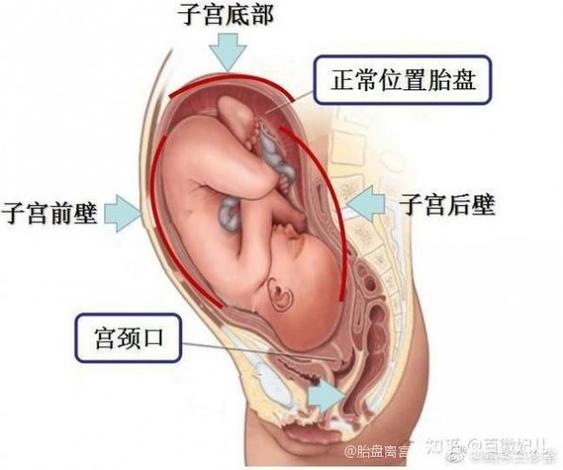 胎盘距宫颈口多少安全