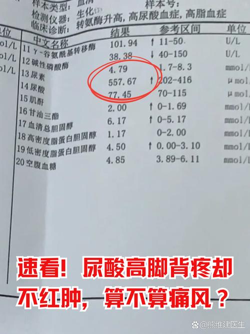 痛风是不是就是尿酸高