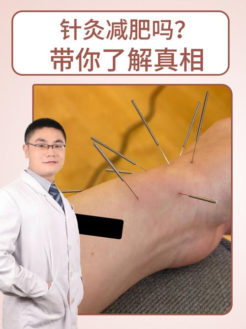 针灸减肥可以吃玉米吗