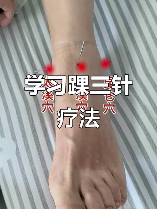 脚踝扭伤针灸起作用吗