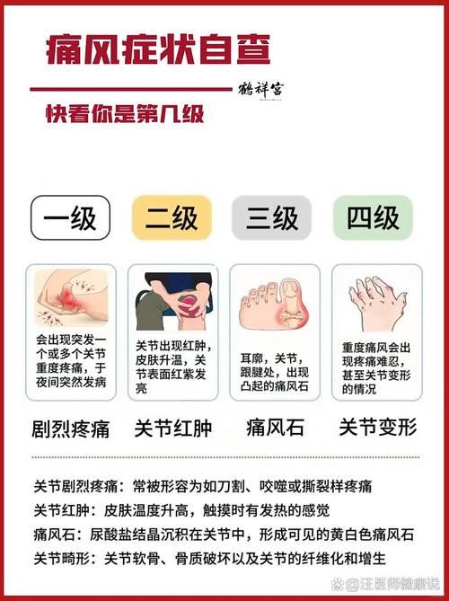 痛风是怎么引起的疾病