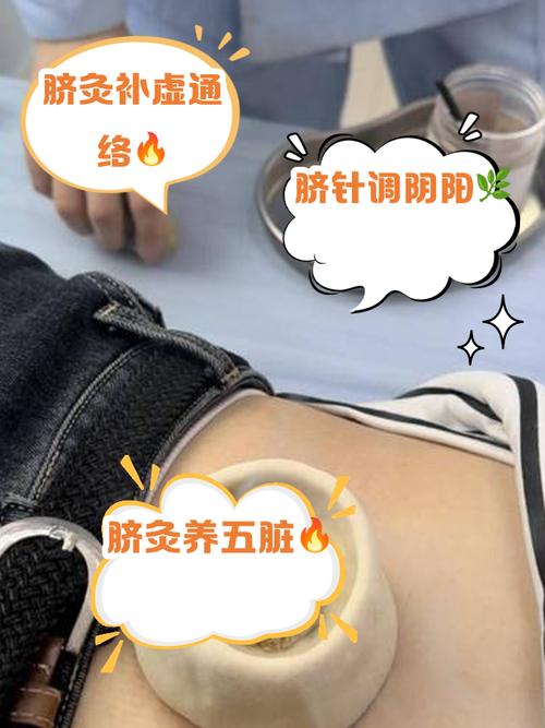肚脐周围扎针灸的作用