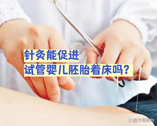 试管移植前做针灸好吗