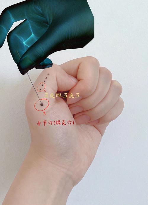 脚扭伤针灸有没有作用