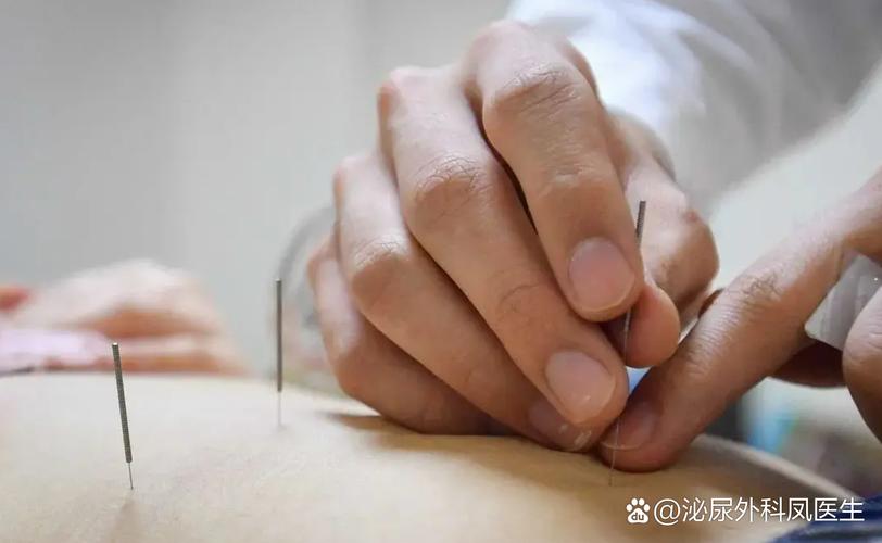 平衡针灸进针手法视频