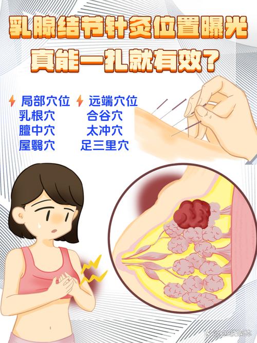 针灸丰胸一次要多少钱