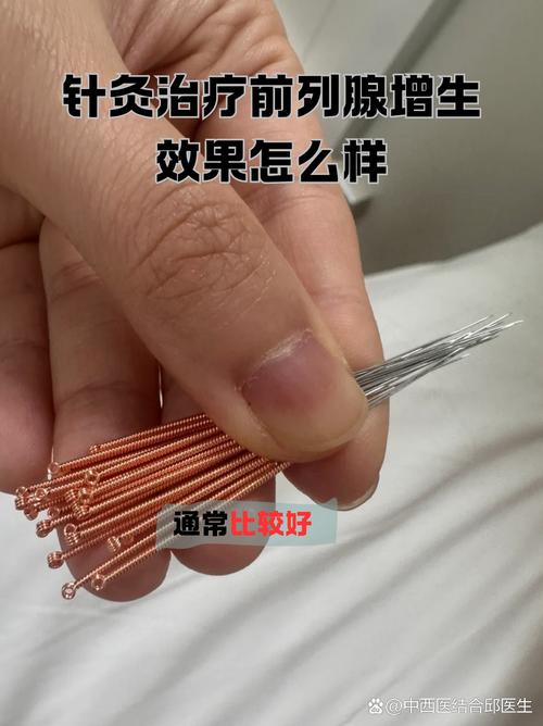 前列腺炎针灸治疗视频