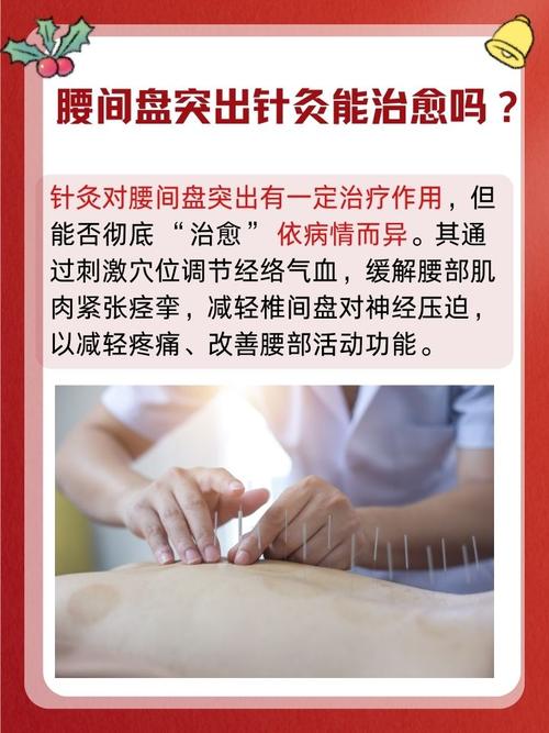 腰间盘突出做针灸好吗