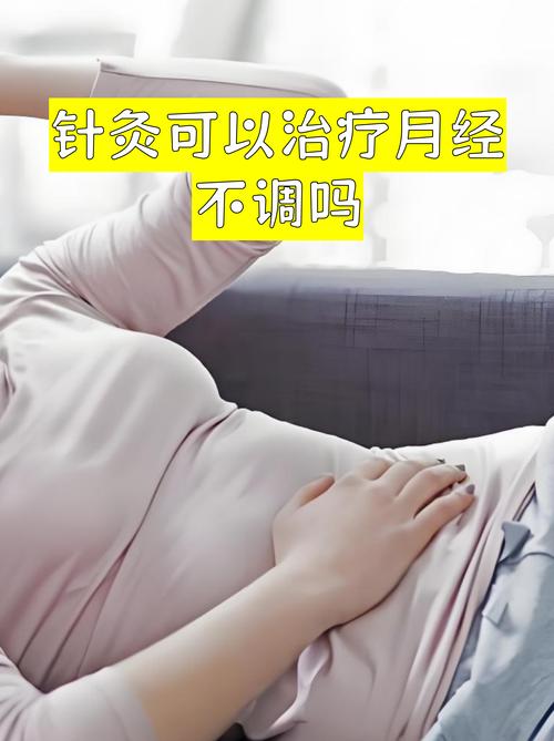 针灸对月经不调有用吗