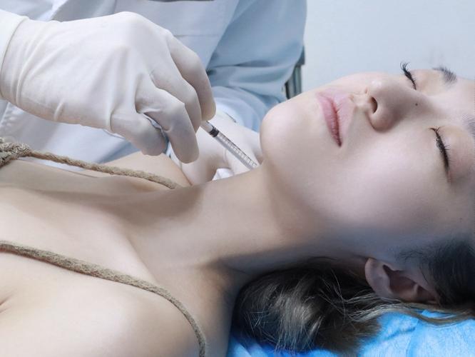 针灸丰胸有成功案例吗