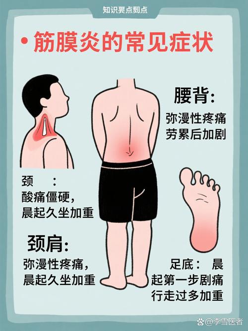 筋膜炎和痛风怎么区别