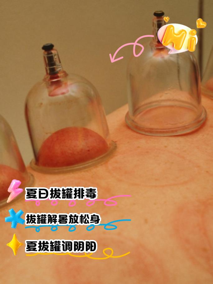 拔罐针灸减肥有效果吗