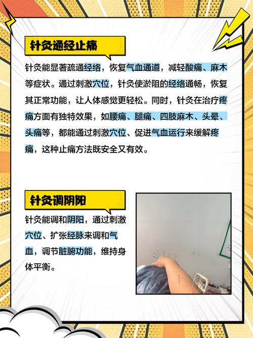 经常扎针灸有副作用吗