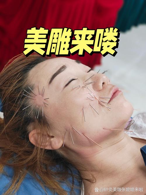 针灸美雕谁做过可靠吗