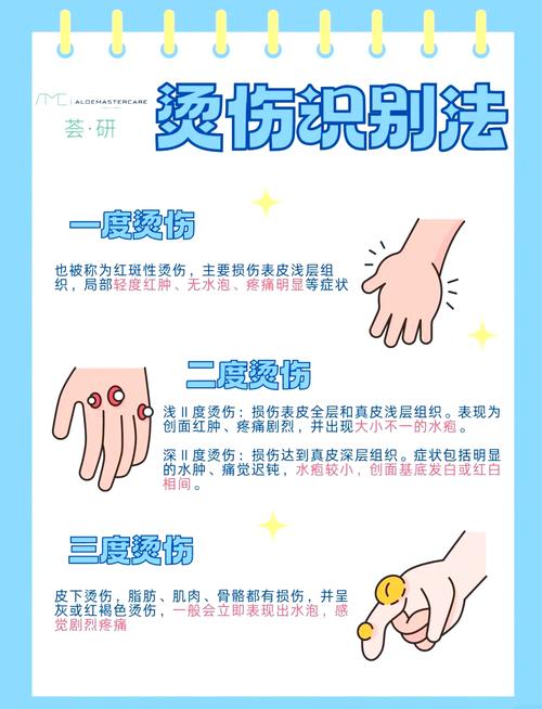 烫伤了怎么办安全视频