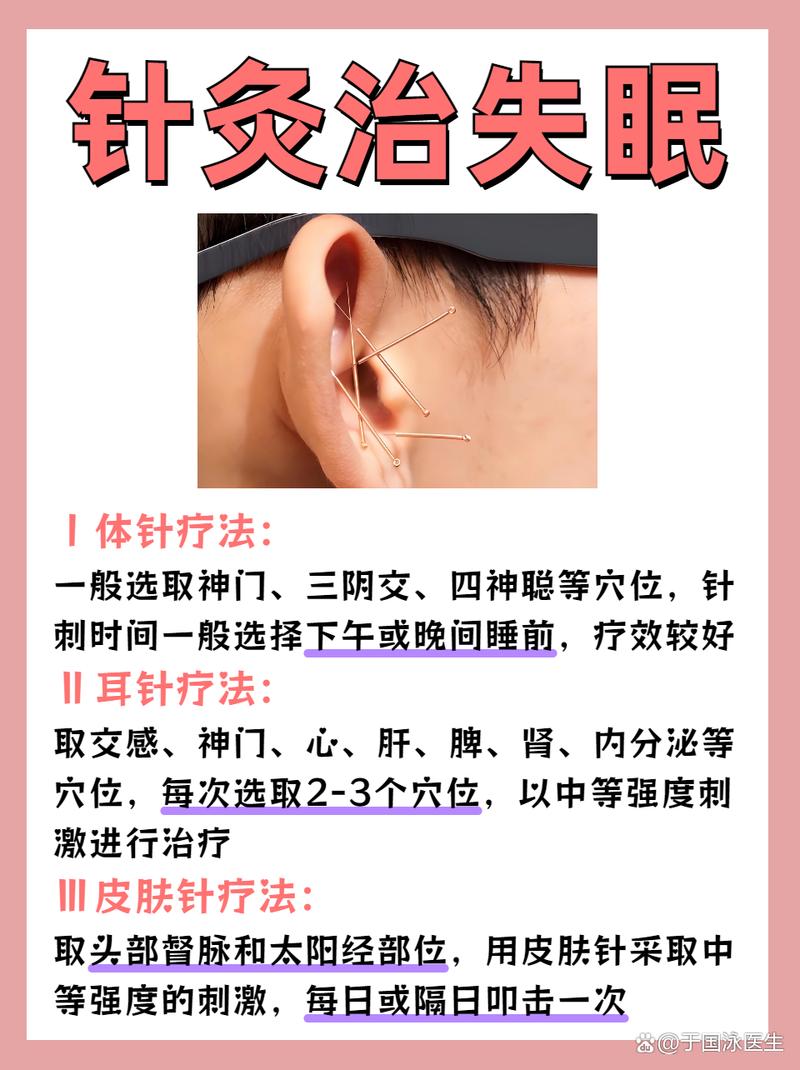 针灸治疗失眠会复发吗