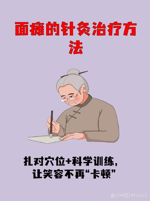 针灸能促进神经恢复吗