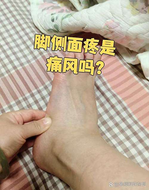 痛风一个月脚还隐隐痛