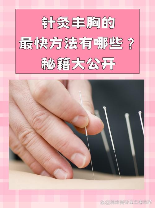乳腺增生针灸位置图片