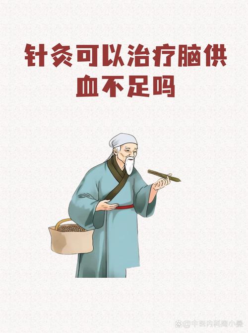 脑供血不足针灸有用吗