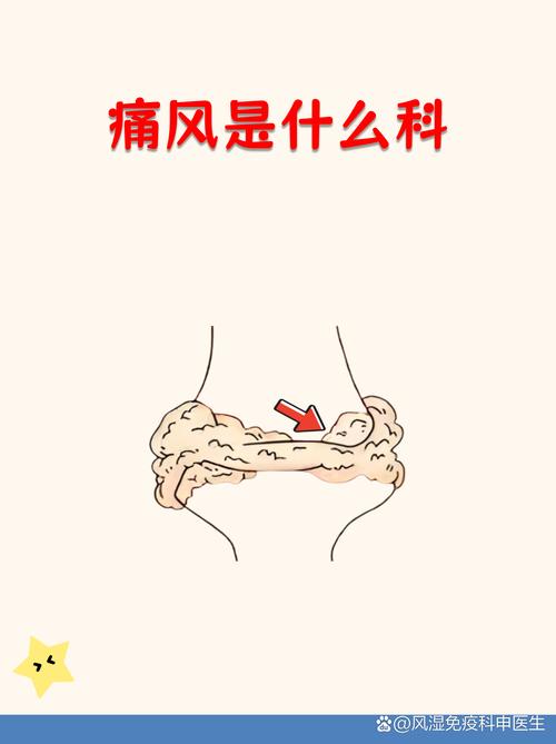 痛风性关节炎挂什么科