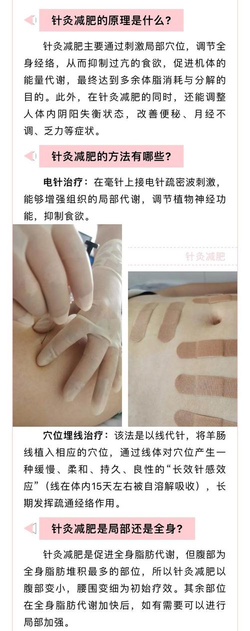 一天最佳针灸减肥时间