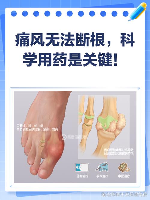 第一次痛风 能治好吗