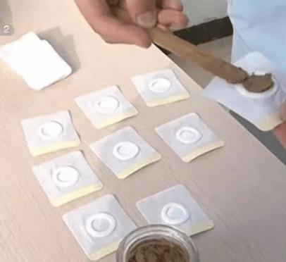 针灸后几个小时能见风