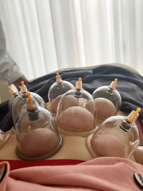 针灸后感觉肚子里有气